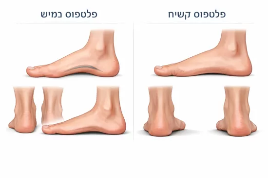 פלטפוס גמיש מול קשיח